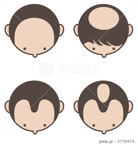 脱毛-14 脱毛-14 5770475