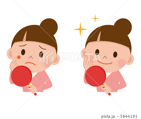 にきびで悩む女性と綺麗になった女性セットのイラスト素材