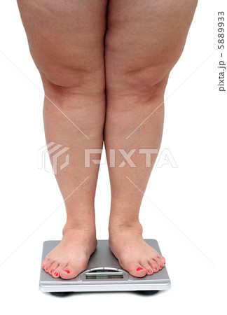 women legs with overweight 5889933