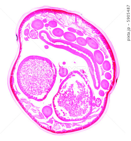 Ascaris under the microscope, background 5905487