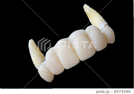 抜け落ちたブリッジ 6073090