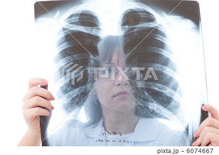 Doctor looking at x-ray 6074667