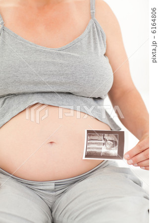 Pregnant woman with her X-ray Pregnant woman with her X-ray 6164806