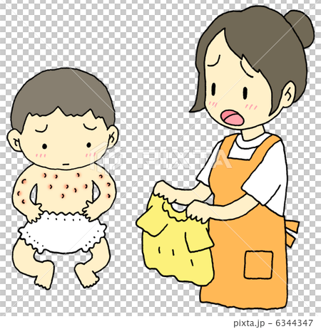 湿疹赤ちゃん 湿疹赤ちゃん 6344347