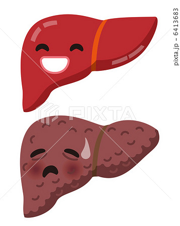 健康な肝臓と不健康な肝臓のイラスト素材