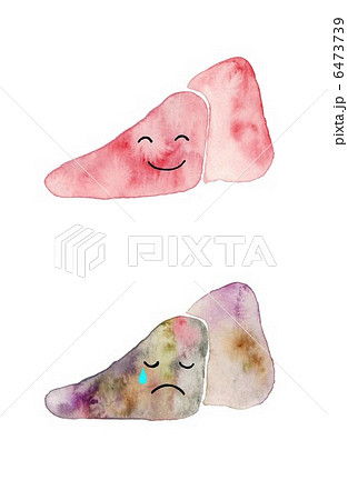肝臓の病気 肝臓の病気 6473739