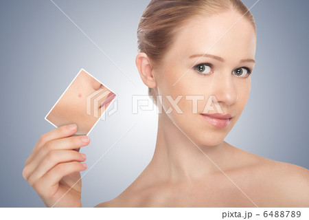 concept skincare . Skin of beauty young woman  6488789