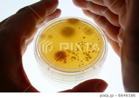 ハウスダストの微生物 6646586