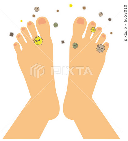 水虫(足の甲）D-2 6658010