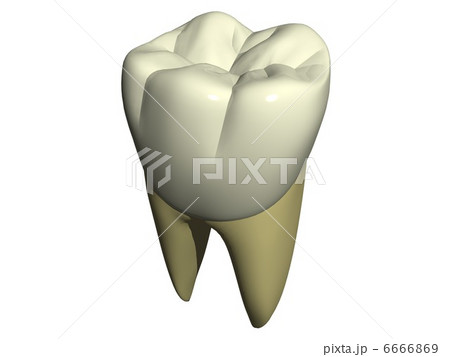 大臼歯近心頬側面観 6666869