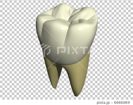 大臼歯近心頬側面観 6666869