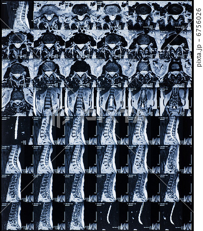 MRI MRI 6756026