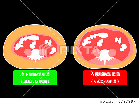 内臓脂肪と皮下脂肪の断面図のイラスト素材