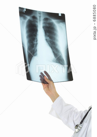 レントゲン 6885080