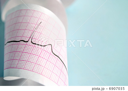 cardiogram 6907035