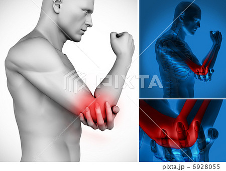 Three images of elbow pain Three images of elbow pain 6928055