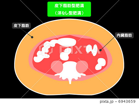 内臓脂肪と皮下脂肪の断面図のイラスト素材