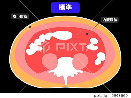 内臓脂肪と皮下脂肪の断面図 6943660