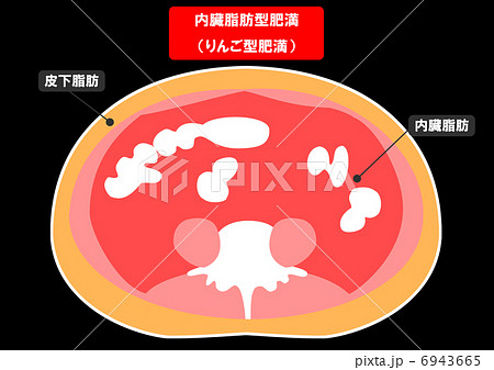 内臓脂肪と皮下脂肪の断面図のイラスト素材