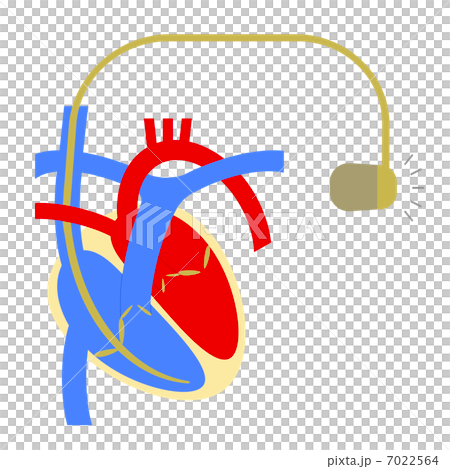 Cardiac pacemaker 7022564