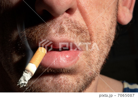 alcoholic with a stub 7065087