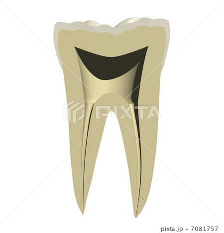 歯の切断面 歯の切断面 7081757