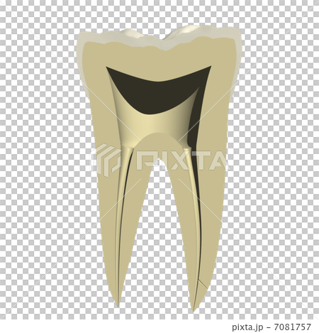 Cutting face of tooth 7081757