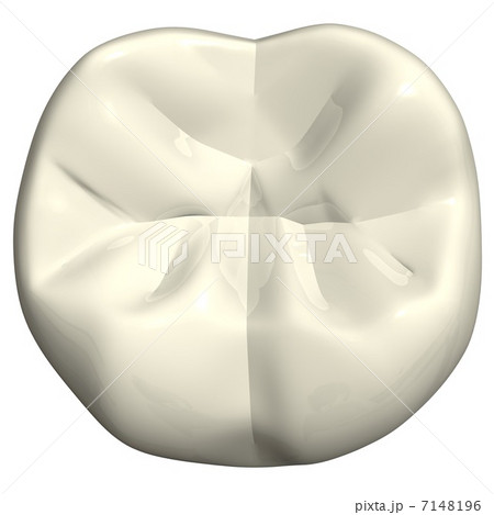 右下7番術前 右下7番術前 7148196