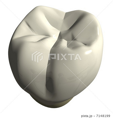 右下7番咬合面観 右下7番咬合面観 7148199