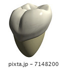 第二大臼歯 7148200