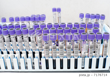 test tubes with donor blood 7176714