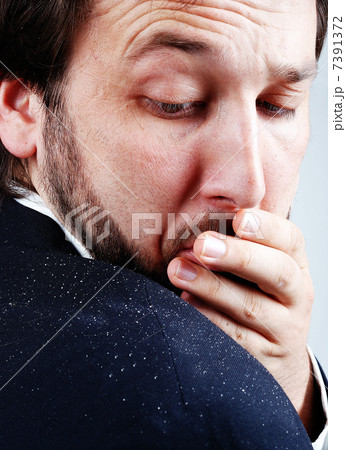 Dandruff issue on mans sholder Dandruff issue on mans sholder 7391372