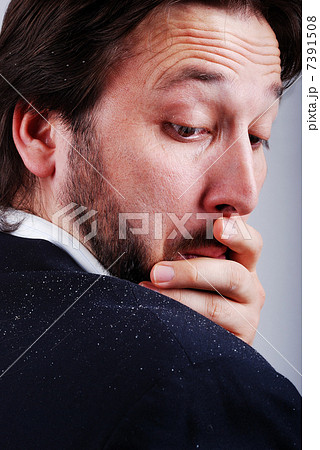 Dandruff issue on mans sholder Dandruff issue on mans sholder 7391508