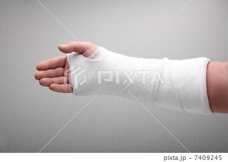 broken arm bone in cast 7409245