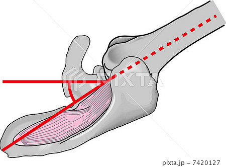 scapular plane 7420127