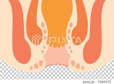 Anal cross section 7464372