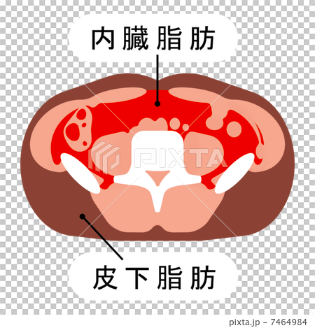 Visceral fat and subcutaneous fat 7464984