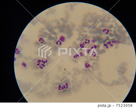 血液の顕微鏡写真の写真素材