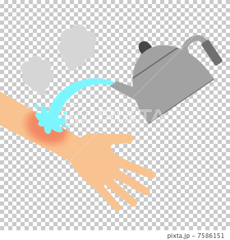 Attention to burn 7586151