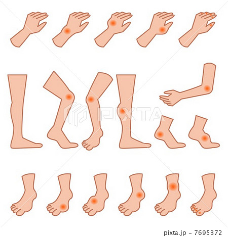 痛風と捻挫の手足セット 7695372