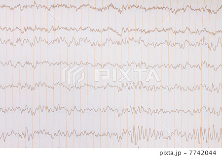 ECG background 7742044