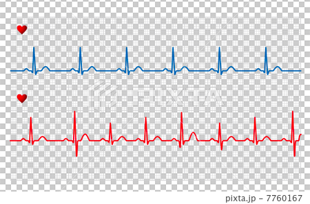 electro-cardiogram 7760167
