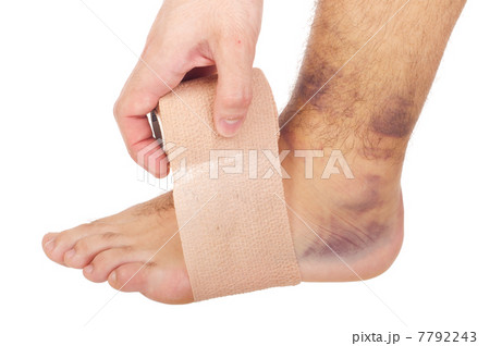 Bandaging a sprained ankle 7792243