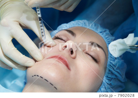 Young woman having facial plastic surgery 7902028