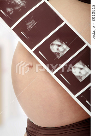Pregnant woman Pregnant woman 8010918