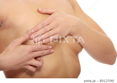 Breast cancer Breast cancer 8012590