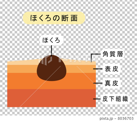 痣的橫截面 8036703