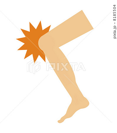 膝痛 膝痛 8185504