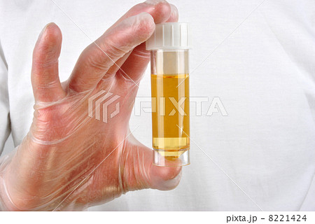 some human urine in a sample bottle 8221424