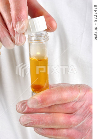 some human urine in a sample bottle 8222429